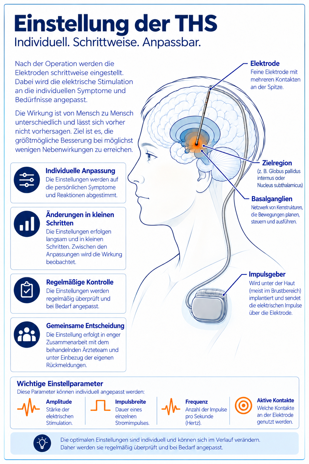 Schematische Darstellung der individuellen Einstellung einer Tiefen Hirnstimulation